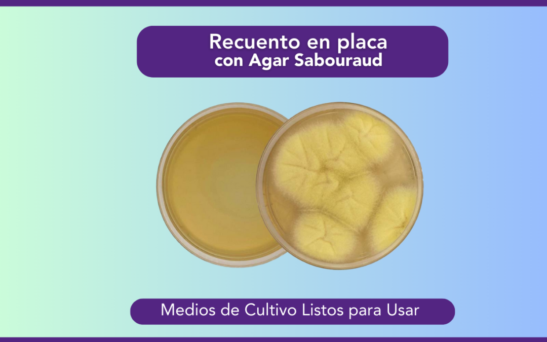 El recuento en placa con Agar Sabouraud: Lo que hay que saber
